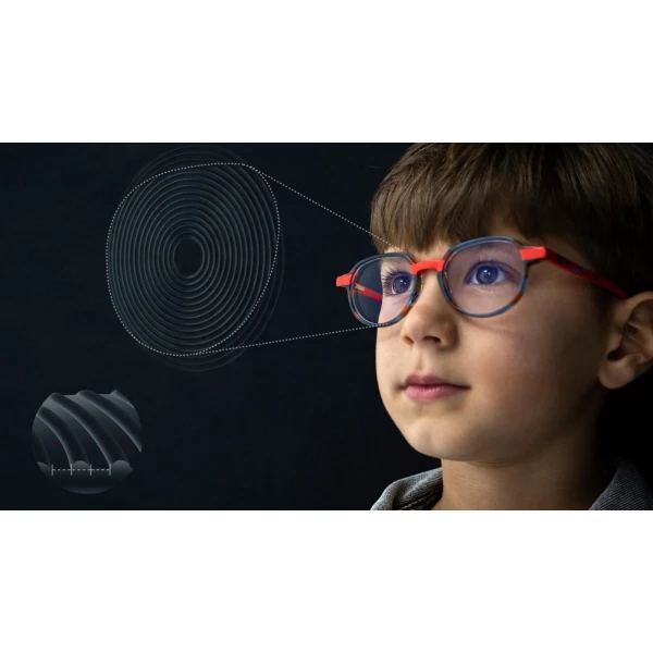 Lentes Myocare (Controle da miopia infantil)